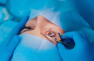 Laser Eye Surgery Cost Thailand procedure melbourne