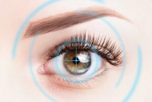 laser eye surgery minimum age requirement