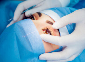 Laser Eye Surgery Belfast procedure