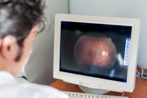 Laser Eye Surgery Ireland diagnostic