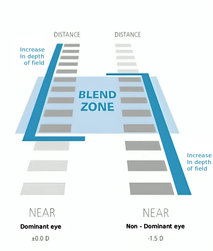 How does PRESBYOND® work?