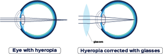 blurred vision problems